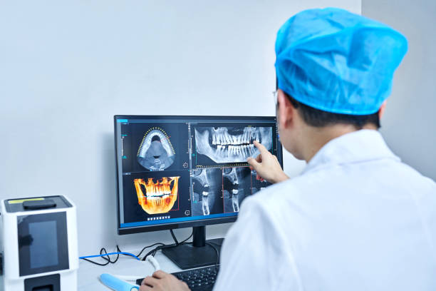 Best Emergency Dentist for Lost Fillings or Crowns in Yardley, PA